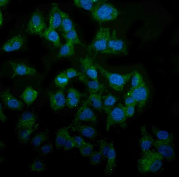 Anti-MAP3K8 Antibody