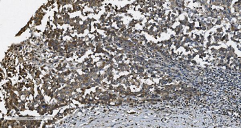 Anti-MAP3K8 Antibody