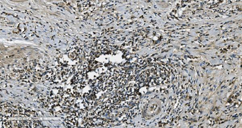 Anti-MAP3K8 Antibody