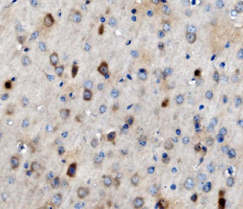 Anti-MAP3K8 Antibody