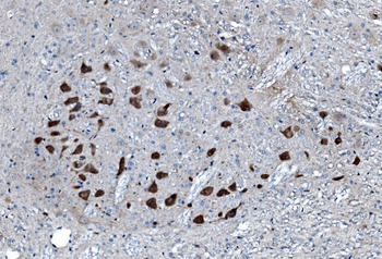 Anti-MAP3K8 Antibody