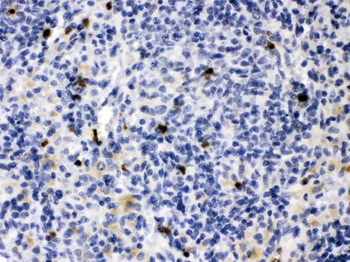 MMP9 Rabbit Polyclonal Antibody