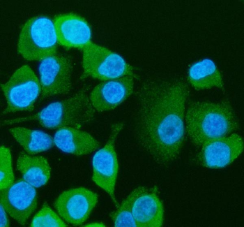 Anti-Visfatin/NAMPT Antibody