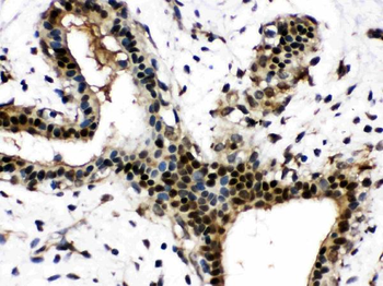 Anti-Visfatin/NAMPT Antibody