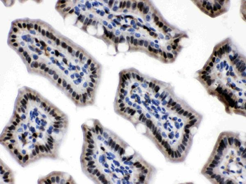 Anti-Visfatin/NAMPT Antibody