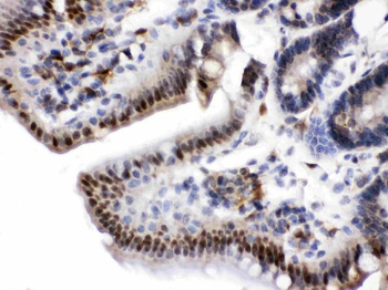 Anti-Visfatin/NAMPT Antibody