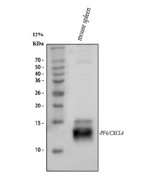 Anti-PF4 Antibody