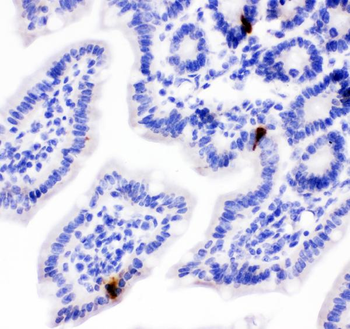 Anti-Peptide YY/PYY Antibody