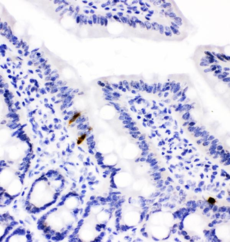 Anti-Peptide YY/PYY Antibody