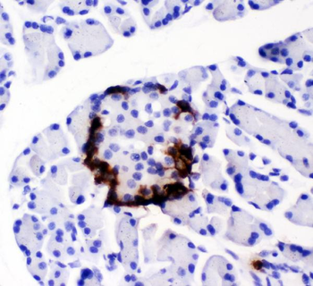 Anti-Peptide YY/PYY Antibody