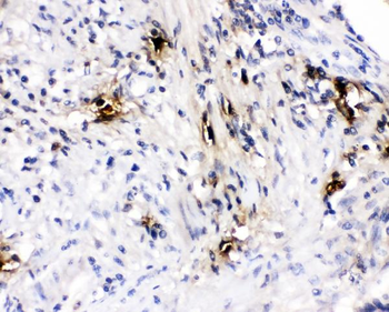 Anti-Mast Cell Tryptase/TPSAB1 Antibody