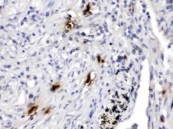 Mast Cell Tryptase/TPSAB1 Antibody