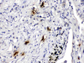 Anti-Mast Cell Tryptase/TPSAB1 Antibody
