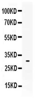 Anti-Mast Cell Tryptase/TPSAB1 Antibody
