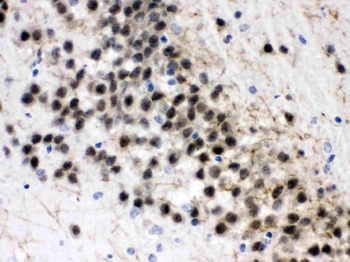 Anti-ZWINT Antibody