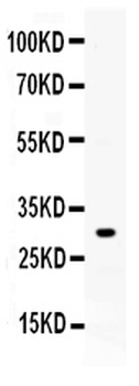 Anti-ZWINT Antibody