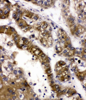 Anti-Alcohol dehydrogenase class-3 ADH5 Antibody