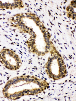 Anti-Alcohol dehydrogenase class-3 ADH5 Antibody