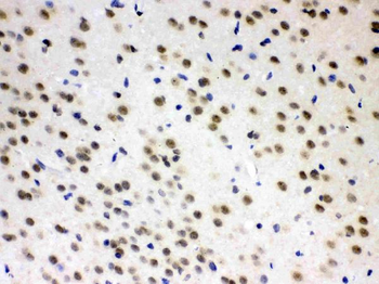 Anti-L-Arginine decarboxylase/AZIN2 Antibody