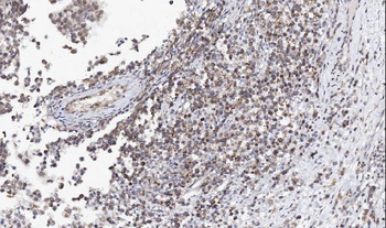Anti-L-Arginine decarboxylase/AZIN2 Antibody