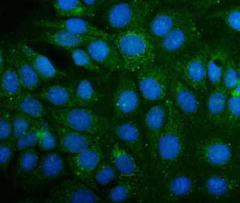 Anti-ABAT Antibody