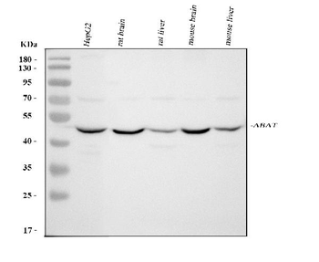 Anti-ABAT Antibody