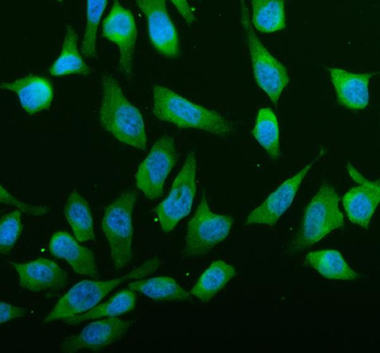 Anti-ABCE1 Antibody