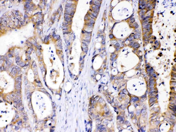 Anti-Abhd5 Antibody