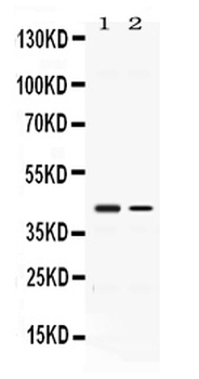 Anti-Abhd5 Antibody
