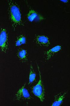 Anti-ACAA2 Antibody