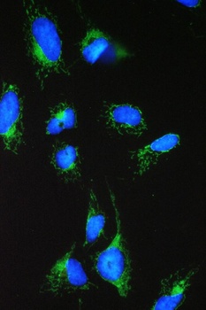 ACAA2 Antibody