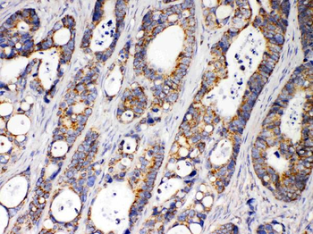 Anti-ACAA2 Antibody