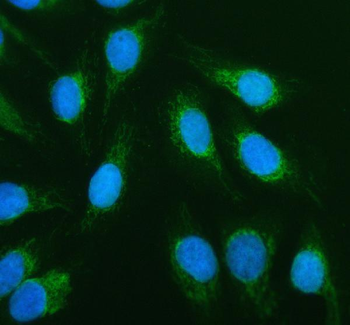 Anti-ACADVL Antibody