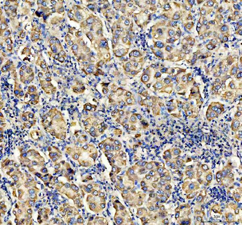 Anti-ACADVL Antibody