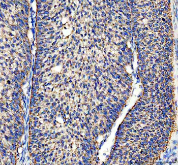 Anti-ACADVL Antibody