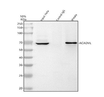 Anti-ACADVL Antibody