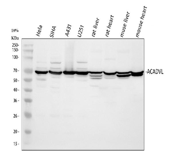 Anti-ACADVL Antibody