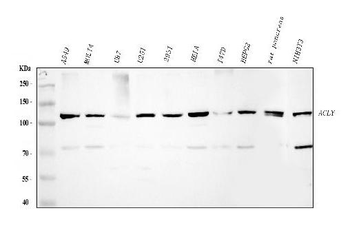 Anti-ATP citrate lyase/ACLY Antibody