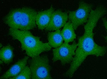 Anti-ATP citrate lyase/ACLY Antibody