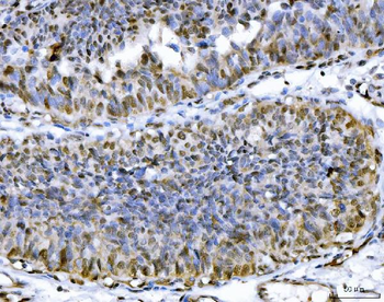 Anti-ATP citrate lyase/ACLY Antibody