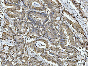 Anti-ATP citrate lyase/ACLY Antibody