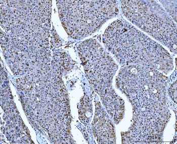 Anti-ATP citrate lyase/ACLY Antibody