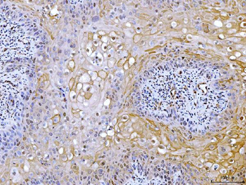 Anti-ATP citrate lyase/ACLY Antibody