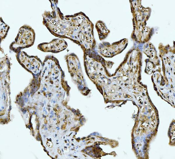 Anti-ATP citrate lyase/ACLY Antibody