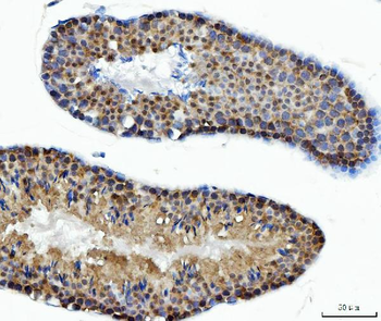 Anti-ATP citrate lyase/ACLY Antibody