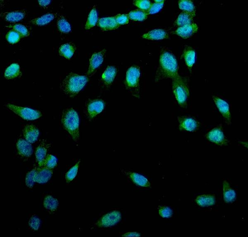 Anti-ACSL1 Antibody