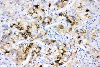 Anti-ACSL1 Antibody