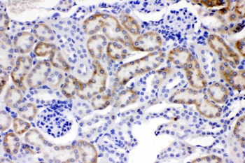 Anti-ACSL1 Antibody
