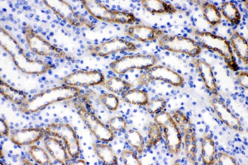 Anti-ACSL1 Antibody