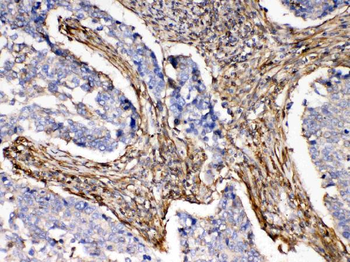 Anti-ACTN3 Antibody